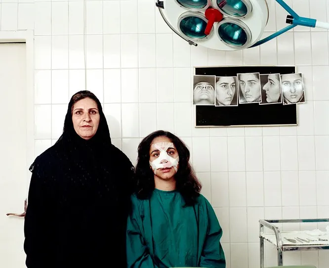 Иран занимает первое место в мире по количеству операций на изменение формы носа. Эльхам, 19 лет, и ее мать, после ринопластики.