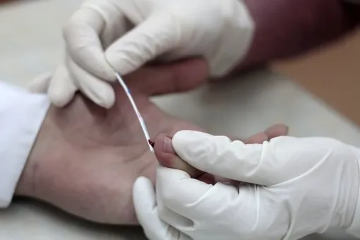 Росздравнадзор счел недостаточно надежными экспресс-тесты на ВИЧ, которые использовались в фильме Дудя