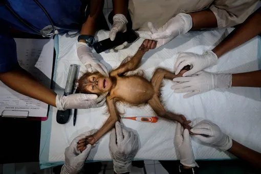 People and nature first place: Alain Schroeder, BelgiumOrangutans in Indonesia are under threat from the ongoing depletion of the rainforest due to palm oil plantations, logging, mining, hunting. This photograph shows a team of rescue workers preparing Brenda, a female orangutan who is estimated to be three months old as she still has no teeth, for surgeryPhotograph: Alain Schroeder/TNC photo contest 2021