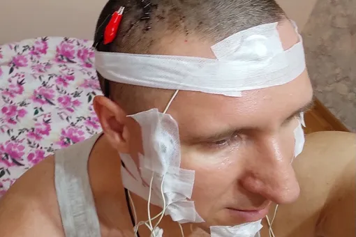 Россиянин в домашних условиях вживил в свой мозг чип, чтобы управлять снами