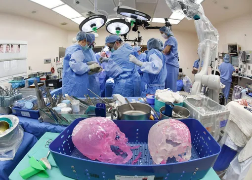 3D-модели черепа Кэти, которые хирурги использовали во время подготовки к операции