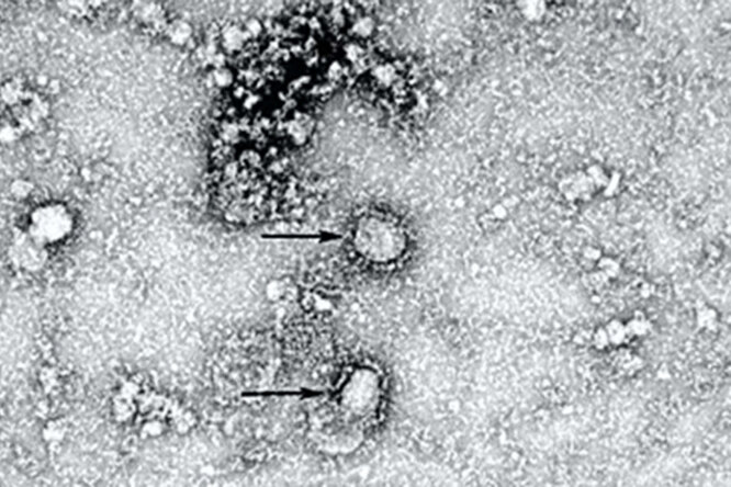 Китай опубликовал первый снимок нового коронавируса