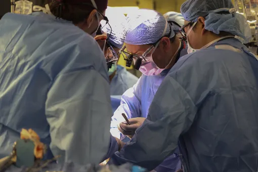 В США выписали из больницы первого в мире человека, которому пересадили генетически модифицированную почку свиньи