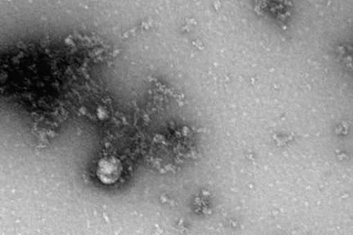 Ученые Роспотребнадзора первыми в мире сделали фотографию «британского» штамма коронавируса