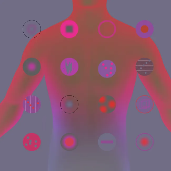 Правдивая ложь: 7 мифов о детском лейкозе