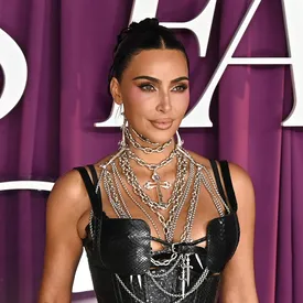 Ким Кардашьян рассказала, что у нее диагностировали аневризму головного мозга