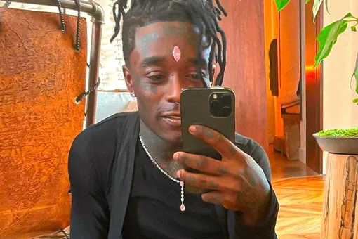 Рэпер Lil Uzi Vert, который ранее имплантировал себе в лоб розовый бриллиант, удалил камень Рэпер Lil Uzi Vert, который ранее имплантировал себе в лоб розовый бриллиант, удалил камень