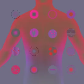 Новая эра лечения рака: какие технологии уже спасают пациентов