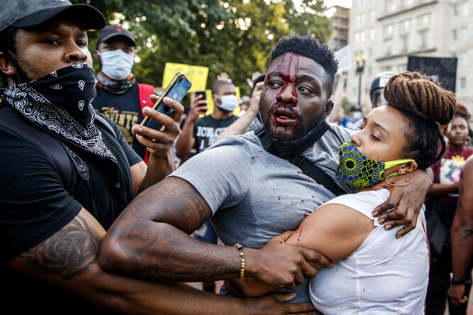 Раненый демонстрант во время протестной акции в Вашингтоне, 30 мая