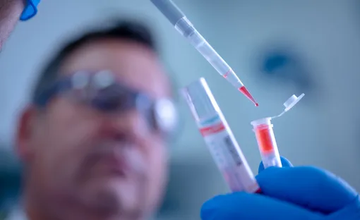 Работник биотехнологической компании Qiagen в Германии демонстрирует тест-систему на коронавирус.