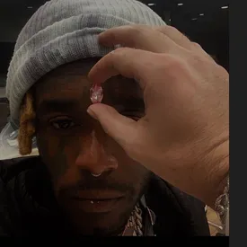 Рэпер Lil Uzi Vert имплантирует в лоб розовый бриллиант стоимостью $24 миллиона