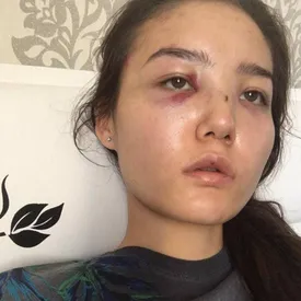 Жена советника казахстанского посла в ОАЭ обвинила его в насилии. МИД Казахстана отозвал дипломата на родину Жена советника казахстанского посла в ОАЭ обвинила его в насилии. МИД Казахстана отозвал дипломата на родину