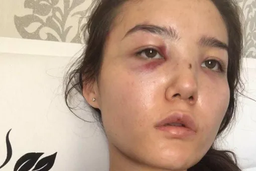 Жена советника казахстанского посла в ОАЭ обвинила его в насилии. МИД Казахстана отозвал дипломата на родину Жена советника казахстанского посла в ОАЭ обвинила его в насилии. МИД Казахстана отозвал дипломата на родину
